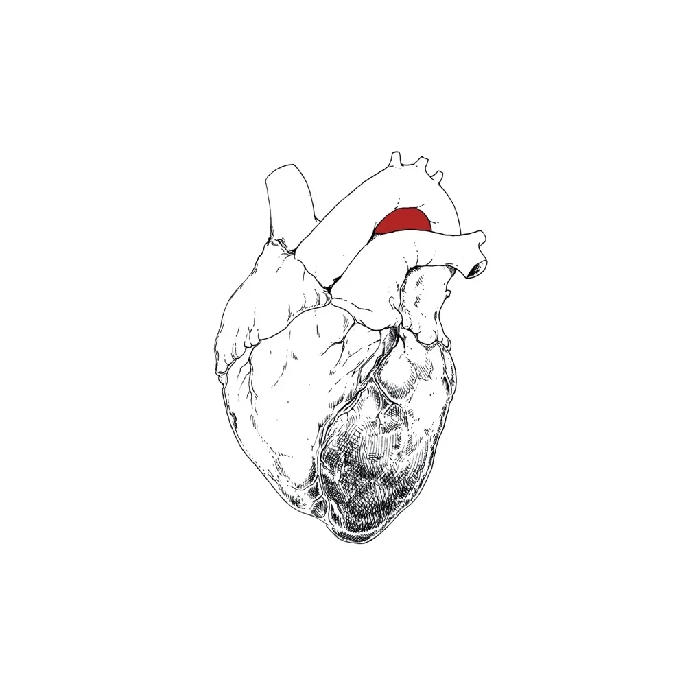 The Beggar - Swans